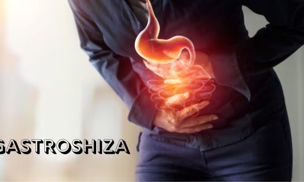 Gastroshiza Explained: Causes, Treatment, and Outlook